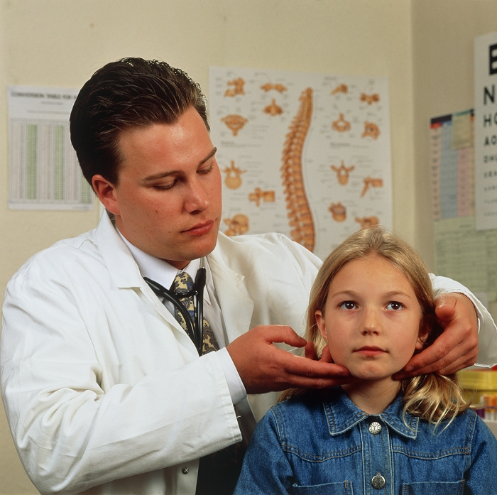 . Paediatric consultation. A doctor examines the glands in the neck of a young girl to check for swelling. The doctor is wearing a white lab coat and has a stethoscope around his neck. Swollen glands are a very common symptom and usually caused by minor infection such as tonsillitis. However, in rare cases they may be indicative of a more serious disorder such as Hodgkin's disease. MODEL RELEASED