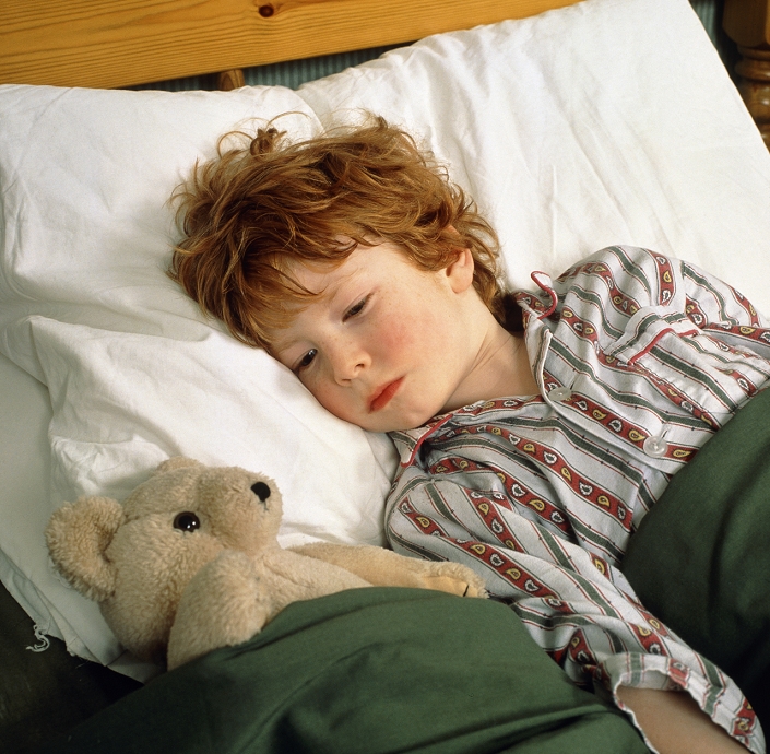 . Feverish child. A young boy suffering fever lies in bed with his teddy bear. The child's rosy cheeks are an indication of fever. Fever, also known as pyrexia, is defined as a body temperature above 37 Celsius (98.6 Fahrenheit) if measured in the mouth. Most fevers are caused by bacterial or viral infections and may be accompanied by other symptoms such as shivering, sweating, thirst and hot skin. MODEL RELEASED
