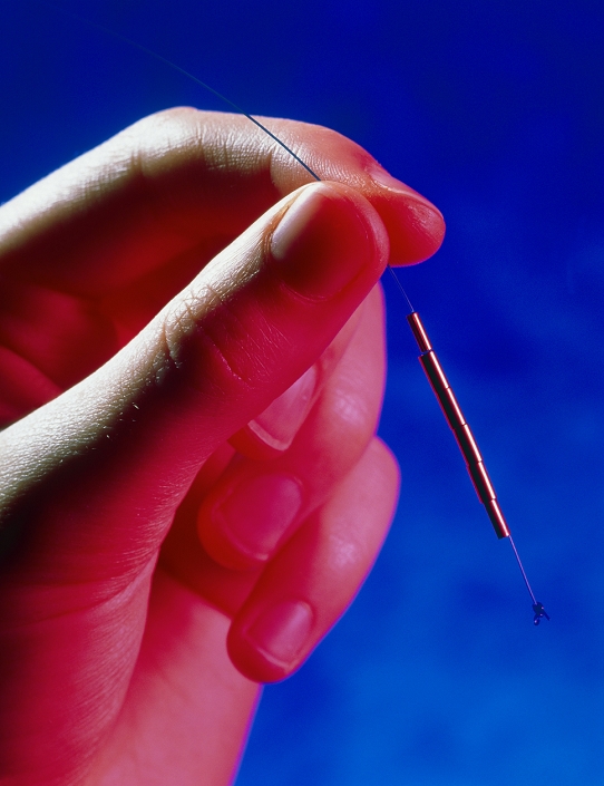 IUD contraceptive. Hand holds a GyneFIX IntraUter- ine Device (IUD) used in contraception. This IUD consists of 6 copper rings on a thread which is implanted in the muscle at the top of a woman's uterus (the fundal myometrium). The device is anchored in the myometrium by the knot at lower right. The thread hangs through the cervix, making it easy to remove. GyneFIX's design makes it unlikely to irritate surrounding tissue or be accidentally expelled. IUDs are thought to work by interfering with the implantation of a fertilised egg in the uterus. The GyneFIX is replaced about once every five years. Users of GyneFIX have a yearly pregnancy rate of only about 0.5%.