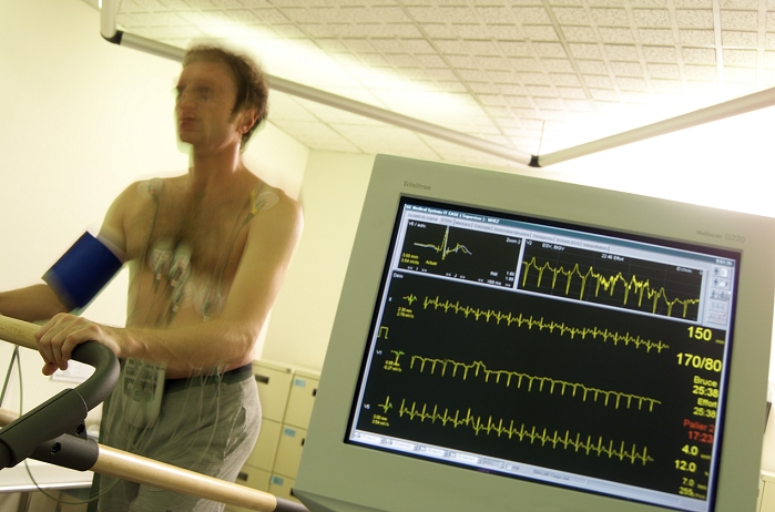 . Fitness test. Man walking on a treadmill during a fitness test. Electrodes attached to his chest measure his heartbeat, and how it responds to exercise. This is an important measure of cardiovascular fitness. Using this method, disorders such as arrhythmia (irregular heartbeat) and some other forms of coronary artery disease can be diagnosed. The blue cuff on his arm is measuring his blood pressure, which is another valuable indicator of health. The data are displayed on the screen at lower right. MODEL RELEASED