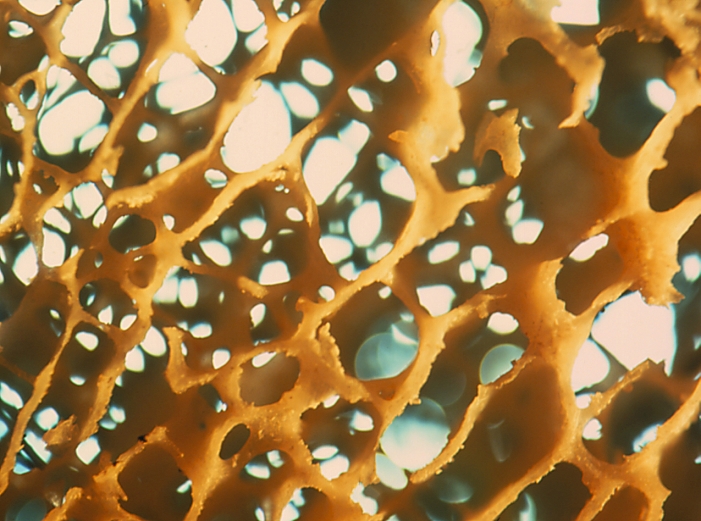 Macrophotograph of human spongy (cancellous) bone. It is composed of a network of bony elements called trabeculae, which form a maze of interconn- ecting spaces that house the bone marrow. The trabeculae are thin & composed of irregular layers (lamellae) of bone & osteocytes (bone-forming cells). Mature long bones in the skeleton consist of two types of lamellar bone: compact bone, which forms the exterior shaft; & spongy bone, which occupies part of the central medullary cavity of the bone. In immature animals the medullary cavities contain the active bone marrow which is responsible for production of blood cells. Magnification: x4 at 35mm size, x10 at 6x7cm size.