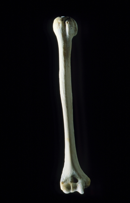 Photograph of the human right humerus, the bone of the upper arm, viewed in anterior aspect. The head of the humerus (top) articulates with the glenoid cavity of the scapula (the shoulder blade) in a ball and socket joint. The trochlea at the lower end of the shaft articulates with the ulna and part of the radius, the two more slender bones of the forearm, at the elbow joint.