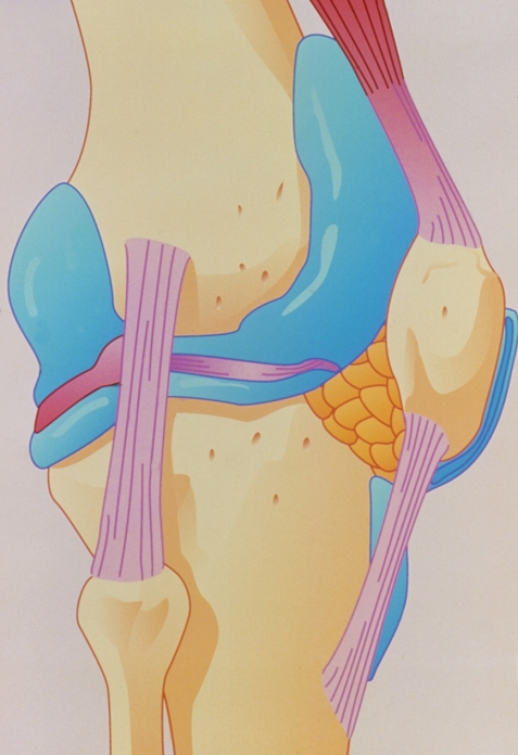 Artwork showing the structure of the knee joint which articulates the femur (upper centre) with the tibia and fibula (bottom). The knee is a strong hinge joint held in alignment by ligaments (light purple) and muscles; it is capable of flexion, extension and very slight rotation. The synovial membrane (blue) forms a large pouch, also known as bursa, which contains a clear fluid that lubricates the joint and eases its movement. The thin horizontal (purple) feature at centre between the femur and tibia shows the position of the menisci; these are discs or cartilaginous tissue which also reduce friction during joint movement. The patella is seen at centre right.