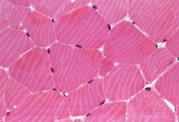 Skeletal muscle. Light micrograph of a transverse section through skeletal muscle fibres. This tissue is under voluntary control and is responsible for the movement of long bones. It is also known as striated muscle, because the regular arrangement of its contractile proteins forms a pattern of alternating light and dark bands (or striations) across the fibre. The cell nuclei (purple) are located at the edge of the fibres and each fibre is surrounded by connective tissue (endomysium, white). This contains the blood capillary network and the nerves which carry signals from the brain to the muscle. Haematoxylin and eosin stain. Magnification: x190 at 35mm size.