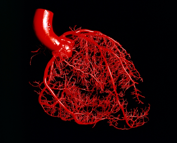 Resin cast of the coronary arteries of the heart in front view, showing the ascending aorta (the large vessel at top left). Branching top and bottom from this are the left and right coronary arteries respectively. Each coronary artery gives off 2 main branches - the circumflex and anterior interventricular from the left (at top of heart), the marginal & posterior interventricular from the right (at bottom left). The resin cast was made by pumping liquid resin into the heart's blood vessels, allowing it to set, then removing any extraneous tissue with sulphuric acid.