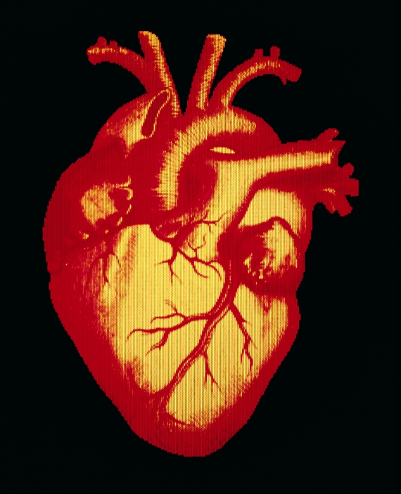 Human heart. Computer-digitised, historical illustration of a healthy human heart. Main arteries that service the heart are visible, with coronary arteries branching on its ventricular surface. As a pump the heart circulates blood around the body. It consists of four chambers. Two chambers on the left side (at right on image) receive oxygenated blood from the lungs and pump it to the body via the aortic arch artery (top centre). Used blood drained from the body is collected and pumped through the right side of the heart, to the lungs via pulmonary arteries (upper centre, beneath aortic arch). Special mechanisms in the heart maintain its cardiac pump-rhythm.