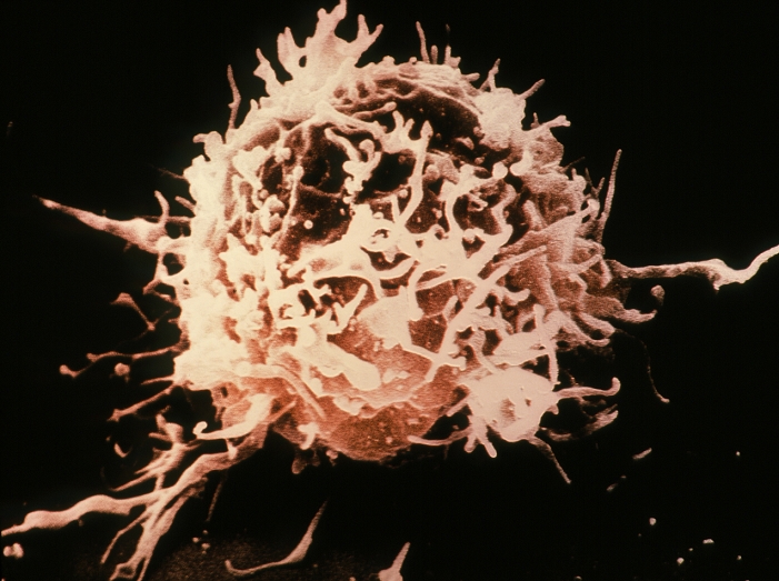 T cell  Date taken unknown  False colour scanning electron micrograph of a normal T lymphocyte, a white blood cell. It is from a culture cell line known as H9. Characteristic of normal T lymphocytes are the long microvilli projecting from the cell surface. T lymphocytes are susceptible to infection by the Human Immunodeficiency Virus  HIV , the causative agent of AIDS. There are three major divisions of white blood cells: granulocytes, lymphocytes   monocytes. Together they protect the body against the invasion of foreign substances   help in antibody production. Magnification: x2750 at 6x6cm size.