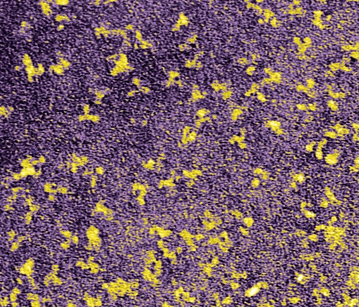 Human antibodies (yellow), coloured transmission electron micrograph (TEM). The Y-shaped structures are molecules of the immunoglobulin G (IgG) antibody. Antibodies are part of the immune system, helping to defend the body against infection by binding to foreign proteins. IgG antibodies are produced by B-lymphocyte blood cells, and they are found in the liquid plasma component of the blood.