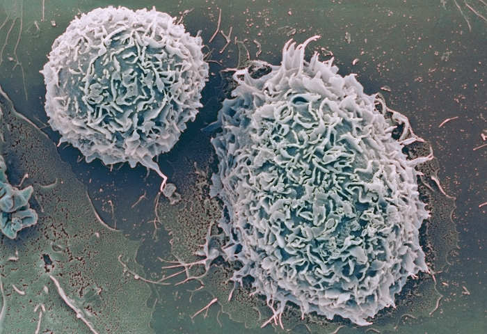 White blood cells. Coloured scanning electron micrograph (SEM) of macrophage white blood cells. These cells are a type of leucocyte present in many major tissues and organs. Free macrophages accumulate at sites of infection as part of the body's immune response. They engulf foreign organisms by a process known as phagocytosis. They are also involved in stimulating immune cells to respond to infection. Magnification unknown.
