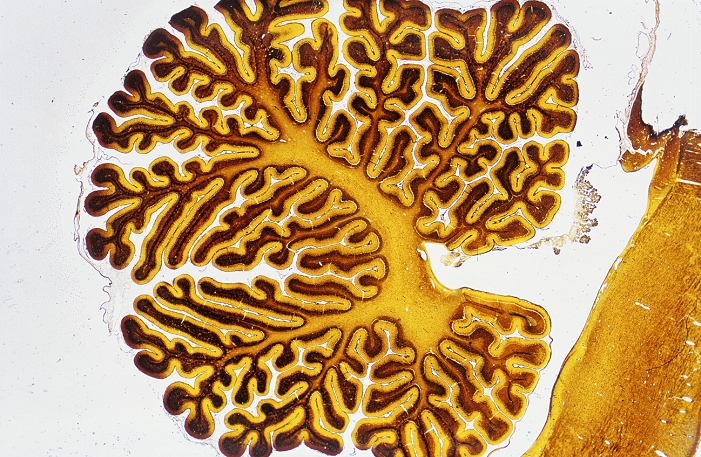 Brain tissue. Light micrograph of a section through the cerebellum of the brain. The cerebellar cortex is composed of two layers; an outer molecular layer (yellow) and an inner granular layer (brown). Together they make up grey matter, which contains the highly folded central core of the cerebellum. This core is white matter (orange) and contains densely-packed nerve fibres. The cerebellum is part of the hindbrain and it controls fine movement co-ordination, balance and muscle tone. Damage to this area leads to motor or movement difficulties. Mag: x5 when 10cm wide.