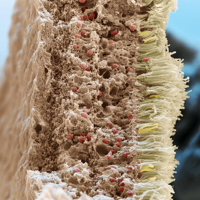 Retina. Coloured scanning electron micrograph (SEM) of a section through a human retina, the light-sensitive tissue that lines the inside of the eye. Light entering the eye passes through several layers of cells before reaching the light receptors. From left to right are seen: the surface layer (brown), cell bodies of optical ganglion cells (pale red), which form the optic nerve; cell bodies of bipolar neurons and of the receptor cells (red); and the rod (white) and cone (yellow) receptors. Rod cells differentiate light and dark, whereas cone cells allow colour vision. Magnification: x840 when printed 10 centimetres wide.