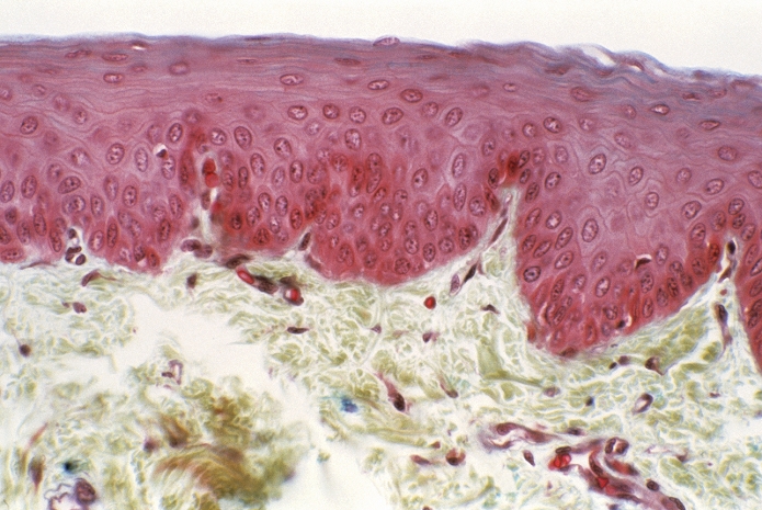 Oesophagus lining. Light micrograph of sectioned tissue from the oesophagus or gullet lining. This tube, which runs from the mouth to the stomach, is lined with a thick, protective epithelium (pink). Beneath the epithelium lies the lamina propria, a layer of supporting connective tissue which contains numerous mast cells (purple). Granules within the mast cells store the chemicals histamine and serotonin, which cause allergic symptoms when they are released. The cells also release heparin, an anticoagulant. Haematoxylin, erythrosine, saffron and alcian blue stain. Magnification unknown.