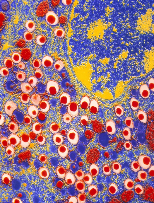 Cells of Langerhans Island Islet of Langerhans. Colour transmission electron micrograph  TEM  of a slice through a cell of the hormone secreting islet of Langerhans in the mammalian pancreas. At top right  blue and yellow  is part of the nucleus of this cell. The red spots in white spaces are membrane bound secretory granules. These contain a densely granular core of hormone separated from the surrounding membrane by a clear space. The islets of Langerhans secrete hormones into the blood   mostly insulin and glucagon, which control blood sugar levels. Magnification x4,800 at 6x4.5cm size.