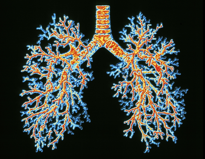 Lung airways. Computer-enhanced image of a resin cast of the airways in the lungs. The trachea (windpipe, top centre) divides into two main bronchi. These branch further into smaller bronchi and then bronchioles. The bronchioles terminate in alveoli (not seen), grape-like clusters of air sacs surrounded by blood vessels. Here, the blood takes up oxygen and releases carbon dioxide to be exhaled.