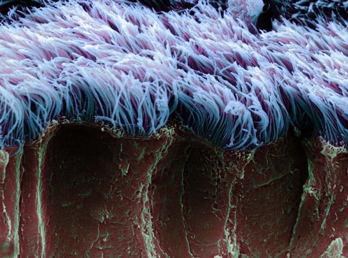 Bronchial cilia. Coloured scanning electron micrograph (SEM) of a normal human bronchial epithelium, the mucus membrane lining the major airways of the lung. Clumps of hair-like cilia (purple/blue) protrude from the tops of specialised epithelial cells (brown/green). Rhythmic movements of the cilia serve to move bacteria and other particles away from the gas- exchanging parts of the lung and towards the throat, where they can be expelled. Magnification unknown.