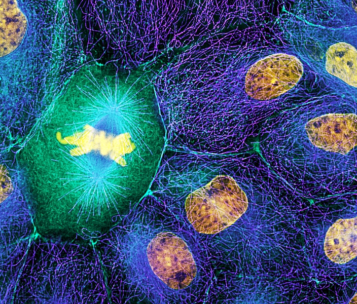 Mitosis. Immunofluorescence light micrograph of a cell (centre left) in metaphase during mitosis (nuclear division). During mitosis two daughter nuclei are formed from one parent nucleus. At metaphase, the chromosomes (yellow) line up along the centre of the cell, and the spindles (light blue) grow from their poles to the centromeres at the centre of each chromosome. Chromosomes are made up of two identical sister chromatids, which are separated into the two daughter nuclei, so that each daughter cell retains the parent cell's genetic information. Spindles are made of microtubules, protein filaments that are part of the cell's cytoskeleton.