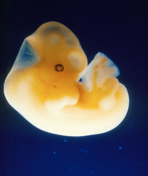 Embryo. A five week old human embryo. Its crown- rump length from the vertex of the skull to the mid-point of the buttocks is about 10-12mm. At this stage the back of the embryo (bottom) grows more rapidly than the front giving the embryo a c- shape. The buds of the limbs are visible as round areas at top left and bottom centre. A rudimentary eye is seen in the head (upper centre right) as a round feature. At five weeks all the internal organs such as the liver, pancreas, heart, and lungs have begun to form; this is the period in which the embryo is at the greatest risk of birth defects due to genetic or external factors.