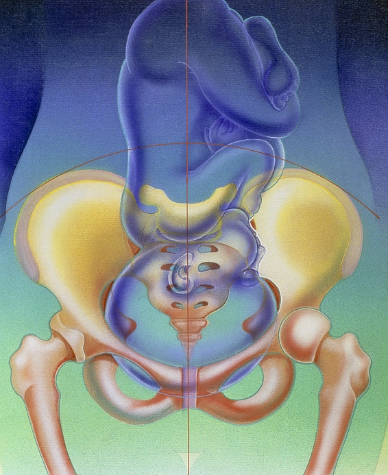 Foetal head presentation. Artwork of a full-term foetus showing normal head (cephalic) presentation within the bones of the pelvis. The pelvis (yellow and pink, centre) is the bony structure at the base of the trunk. It supports the upper half of the body and protects the lower abdominal organs. As childbirth approaches in pregnancy the position of the foetus settles. The foetus and womb drop down together so that the head of the foetus is engaged within the bones of the pelvis as seen here. In the first stages of labour the foetus's head will rotate to enable it to fit through the pelvis during birth.