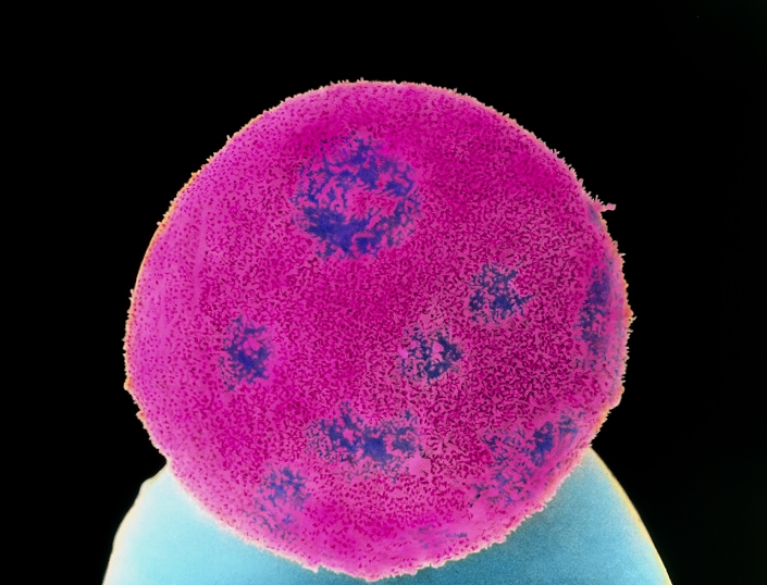 Unhatched blastocyst embryo. Coloured scanning electron micrograph (SEM) of an unhealthy human embryo at the blastocyst stage, six days after fertilisation. This embryo will abort. It is seen on the tip of a pin (blue). It is covered by the zona pellucida (pink, furry), a protein shell that originally surrounded the unfertilised egg. The zona pellucida surface is uneven but intact. At the six day stage, the blastocyst should have hatched from this 'shell' and would appear as a hollow ball of cells. The blastocyst at this stage would be found in the uterus (womb), and if it was healthy it would have implanted on the wall of the womb. Magnification: x600 at 5x7cm size. x2100 at 8x10'