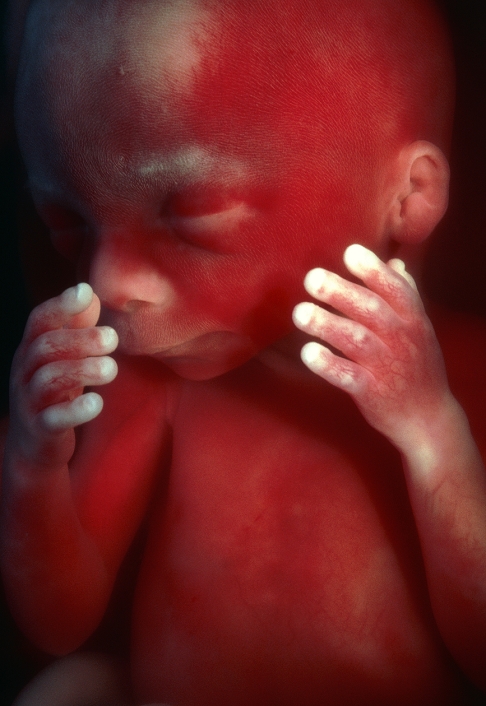 19 week old foetus. View of the face and upper torso of a 19 week old male foetus. His ear is visible, along with his mouth, nose and closed eyes. At this age the foetus appears completely human. Fingers and toes have formed and the skin is covered with a fine hair called lanugo. Blood vessels can be seen within his fingers. The foetus' crown-rump length at 19 weeks is about 18 cm and his body weight is about 400 grams.