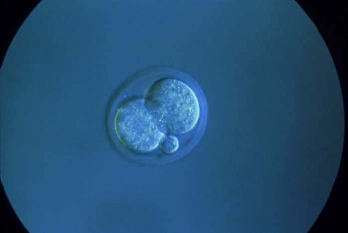 Light micrograph of the embryo of a mouse at the two-cell stage. It is completely surrounded by a thin, resistant glycoprotein layer, the zona pellucida which a spermatozoon penetrated in order to fertilise the egg. A polar body is also here visible as a tiny sphere. At fertilisation three such cells are present together with the larger, fertilised egg cell known as the secondary oocyte. The secondary oocyte, by successive mitotic divisions, gives rise to the foetus whereas the polar bodies shortly degenerate. The embryo of a mouse reaches the four-cell stage 1.5- 2 days after ovulation and, a day after, it enters the uterus. Magnification unknown.