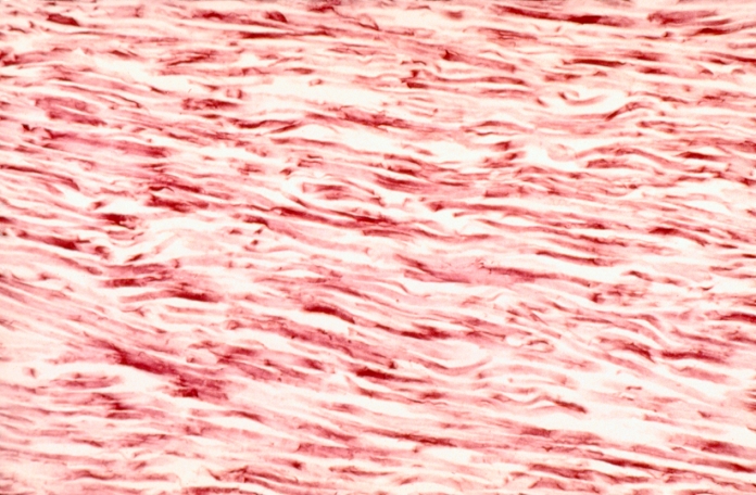 Photomicrograph, longitudinal section of yellow elastic tissue, ordinary connective tissue with the addition of elastin, found in ligaments and walls of arteries. (LP)