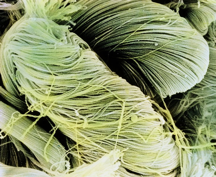 Collagen in the urinary bladder. Coloured Scanning Electron Micrograph (SEM) of collagen fibrils found in the bladder. Here, thin fibrils are packed together into bundles, and these bundles are then spirally twisted. Collagen is a protein whose fibrils are relatively inelastic but have a high tensile strength. In the urinary bladder they are found in the submucosa layer of the bladder wall. This bladder is empty and the collagen bundles are compacted. As the bladder swells, the bundles untwist until they reach full extension. Collagen prevents overstretching of the bladder. Magnification: x3,930 at 6x7cm size. Magnification: x5,000 at 4x5 inch size.