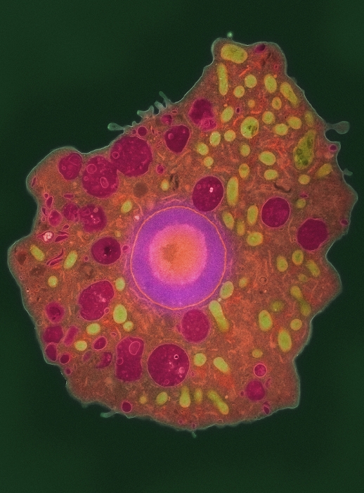 Naegleria fowleri protozoan. Coloured transmission electron micrograph (TEM) of a section through a Naegleria fowleri protozoan. The nucleus (purple) contains a large nucleolus (orange), in which ribonucleic acid is synthesised. This organism is an opportunistic pathogen of humans, causing meningoencephalitis (inflammation of the brain and its surrounding membranes) when inhaled, often by children swimming in fresh water. Headaches, vomiting, sensory disturbance and a fatal coma may occur if the victim is not treated, often with a combination of antibiotics and anti-fungal drugs. Magnification: x3300 at 6x7cm size.