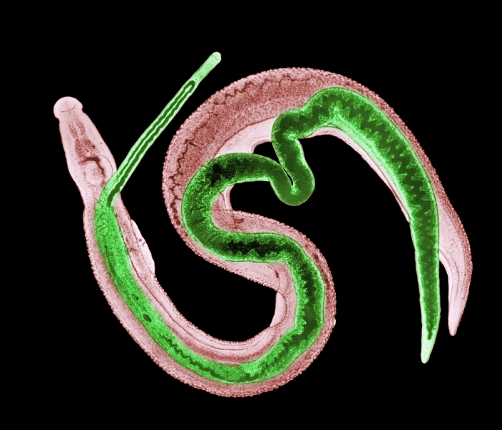 Schistosome parasites. Computer-enhanced light mi- crograph of adult male (brown) and female (green) Schistosoma mansoni parasitic flukes, cause of the disease bilharzia (schistosomiasis). Their heads are at upper left. They live in veins in the human intestines and bladder. Females occupy a groove on the males' backs. They fix themselves to blood vessels and feed on blood cells. Females lay eggs continuously, which are excreted in urine and faeces into lakes and rivers. In water snails, they develop into forms which can infect humans through the skin. Bilharzia is endemic in tropical countries, and can cause liver and kidney damage. It is treatable with drugs. Magnification unknown.
