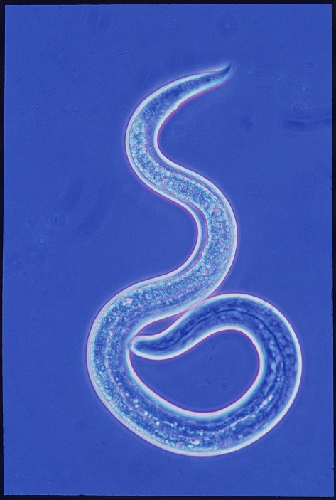 Light micrograph of the 1st larval stage of the dog roundworm Toxocara canis, the cause of toxocariasis in man. Toxocariasis is a parasitic infestation caused by oral contact with material contaminated by eggs deposited in dog faeces. The larvae migrate around the body destroying various tissues; the liver may enlarge & the lungs inflame. Symptoms include fever, joint & muscle pains, vomiting & convulsions; larvae may lodge in the retina of the eye, causing inflammation & granuloma. Widely distributed throughout the world & primarily affecting children, there is no satisfactory treatment for the disease. Magnification:x128 at 35mm , x237 at 5x7cm size.