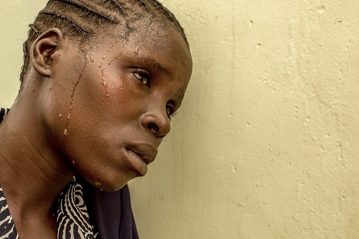 Woman sweating due to malaria Editorial use only   Woman sweating due to malaria. Malaria is a severe disease caused by Plasmodium parasites, which are transmitted to humans by blood feeding Anopheles mosquitoes. The disease results in severe cyclic fevers. It is particularly prevalent in tropical areas of the world. Photographed in Lacor, Gulu, Uganda. 