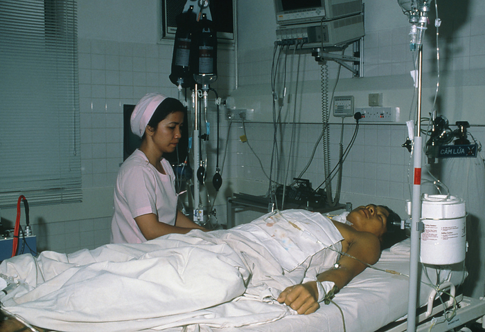 Vietnam Malaria  date of photograph unknown  Intensive care. A nurse watches a malaria patient under intensive care. Drips   blood transfusion equipment are present. Malaria is a tropical dis  ease caused by protozoan organisms which are tran  smitted by mosquitoes. Plasmodium falciparum causes malaria which may be fatal within days. The organisms invade the bloodstream, and multiply in the red blood cells which rupture releasing more organisms. Red cell destruction can lead to jaundice, kidney failure, convulsions   coma after an initial fever. In such severe cases emergency treatment is required using antimalarial drugs   blood transfusions. Malaria affects over 200 million people each year. Photographed in Vietnam. 