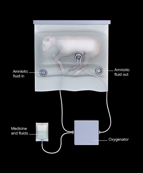 Artificial uterus with lamb foetus, illustration Artificial uterus. Illustration showing an artificial uterus allowing a foetal lamb to grow to term outside the body of its mother. In 2017 US researchers, grew premature lamb foetuses for four weeks in an extra uterine life support system. Each lamb was placed in a plastic bag filled with artificial amniotic fluid. The umbilical cord was attached to a machine outside of the bag, designed to act like a placenta, providing oxygen and nutrients and removing waste. The lamb was kept in a dark, warm room with sounds of the mother s heart. The system succeeded in helping the premature lamb foetuses to develop normally for a month.