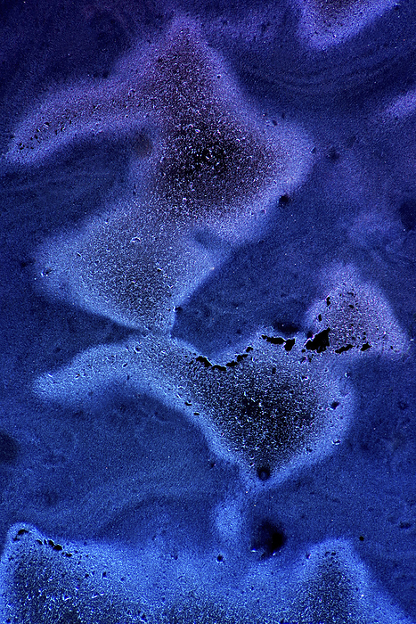 Hyaluronic acid, polarised light micrograph Hyaluronic acid, polarised light micrograph. Hyaluronic acid is a polysaccharide found in the joint spaces, where it acts as a lubricant, and is also a major component of cartilage and skin. It is used to treat osteoarthritis and in eye surgery, and is also used as an anti wrinkle treatment. Dark field illumination. Magnification: x140 when printed at 10 centimetres tall.