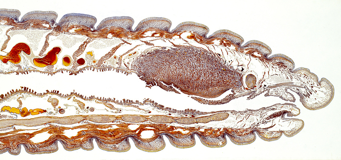 Earthworm longitudinal section, light micrograph Earthworm longitudinal section. Light micrograph of a longitudinal section through the body of a common earthworm  Lumbricus terrestris , showing the internal structures.
