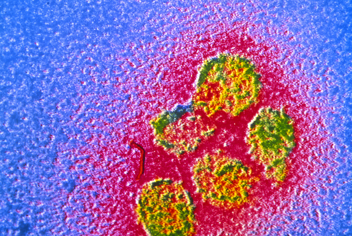 TEM of virions of yellow fever virus False colour transmission electron micrograph  TEM  of virions  virus particles  of the yellow fever virus, a member of the flavivirus sub group of arboviruses  RNA viruses possessing icosahedral symmetry and lipid envelopes . Togavirus diseases such as yellow fever are common where animal hosts and insect vectors are numerous  the yellow fever virus is borne by the mosquitoes Haemogogus sp. in South America and Aedes sp. in Africa, in whom it replicates but causes no disease. Infection in man occurs through a mosquito bite, giving rise to necrosis  cell death  of liver and kidneys, and internal haemorrhaging. Magnification: X 117,000 at 35mm size.