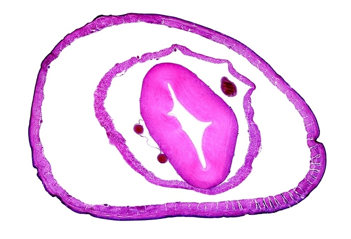 Earthworm heart region, light micrograph Light micrograph transverse section through the body of a common earthworm  Lumbricus terrestris  showing the internal structure in the heart region.