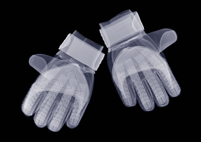 Pair of gloves, X ray Pair of gloves, X ray.