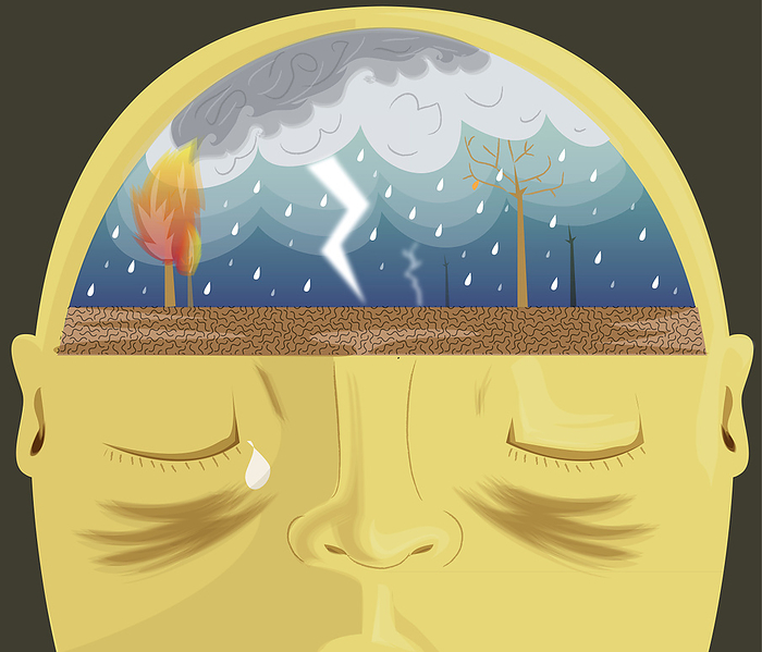 Headache, illustration Human head with heavy rain depicting headache, illustration.