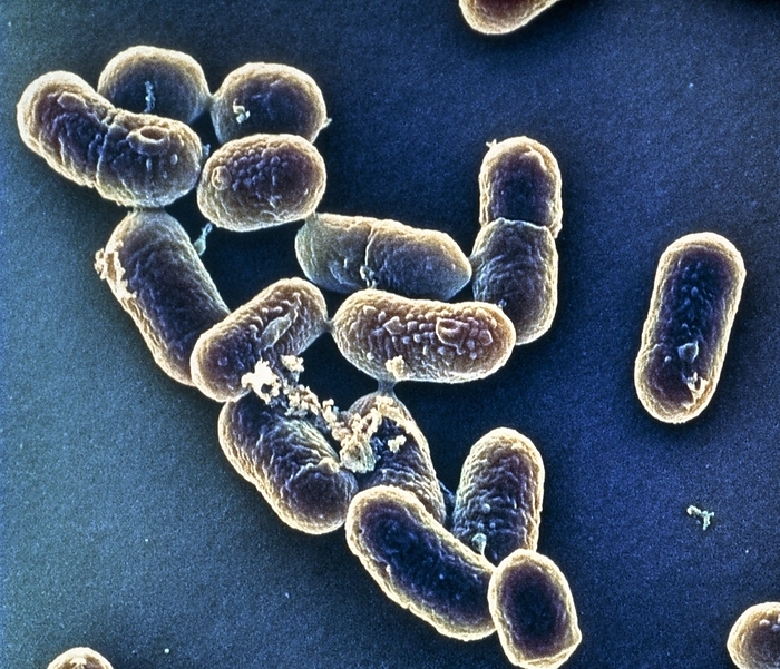 Listeria bacteria, SEM Listeria bacteria. Coloured scanning electron micrograph  SEM  of Listeria monocytogenes bacteria. These Gram positive bacteria cause listeriosis, a form of food poisoning that results in abdominal pains, fever and diarrhoea. Severe infections may be fatal. The bacteria are widespread in the environment, particularly in soil, and infect humans through contaminated foodstuffs. Sources of infection include milk, soft cheese and improperly cooked meat. Treatment is with antibiotic drugs. Magnification: x25,000 at 35mm size.
