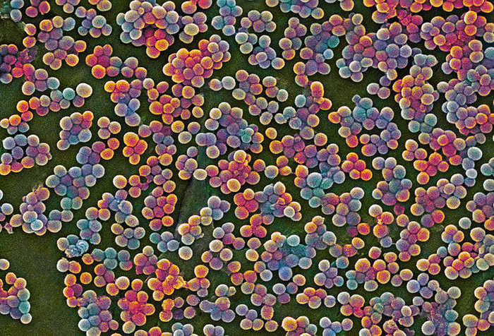 MRSA bacteria, SEM MRSA bacteria, coloured scanning electron micrograph  SEM . Methicillin resistant Staphylococcus aureus  MRSA  is a Gram positive, round  coccus  bacterium. It is resistant to many commonly prescribed antibiotics. S. aureus is carried by around 30  of the population without causing any symptoms. However, in vulnerable people, such as those that have recently had surgery, it can cause wound infections, pneumonia and blood poisoning. The spread of MRSA can be prevented by health workers washing their hands between patients and before procedures. Magnification: x2500 when printed at 10 centimetres wide.