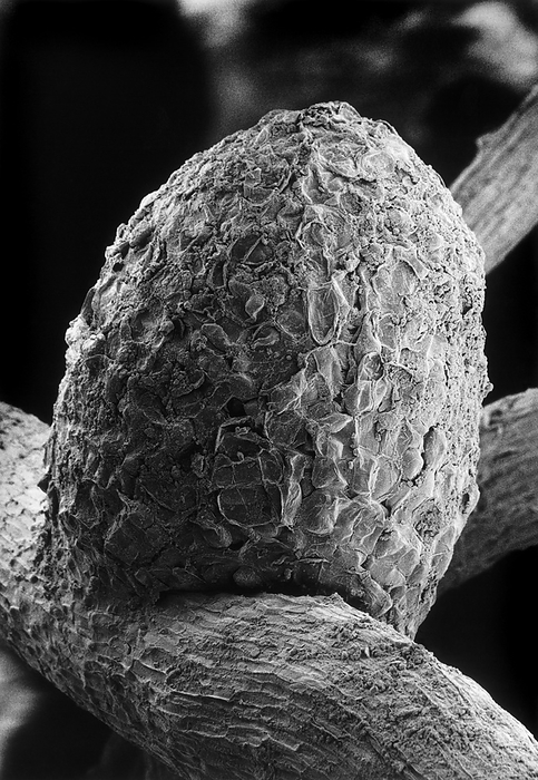 Nitrogen fixing root nodule of clover plant Scanning electron micrograph of a root nodule on the white clover plant, Trifolium repens, caused by the nitrogen fixing bacteria Rhizobium trifolii. The bacteria convert atmospheric nitrogen into a usable organic form, which the clover cannot do itself, but which is imperative for its survival. Bacteria infect the plant through root hairs, forming a nodule site. Here they divide repeatedly, swell and become known as bacteroids. The nodule consists of a central region filled with bacteroids surrounded by a spongy region, the cortex, seen here. Magnification: x175 at 8x10 inch size.