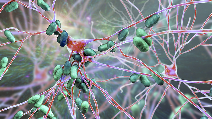 Bacterial encephalitis, illustration Bacterial encephalitis. Conceptual computer illustration showing bacteria infecting brain cells.