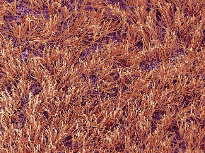 Brain lining, SEM Brain lining. Coloured scanning electron micrograph  SEM  of the lining of the brain, showing the ciliary hairs of ependymal cells. Ependymal cells are a type of neuroglia  glial cells  that line the ventricles of the brain and produce cerebrospinal fluid  CSF . CSF has a number of functions, including buffering the brain from shock, transporting hormones around the brain and absorbing waste products. The ciliary hairs are used to help circulate the CSF. Magnification: x800 when printed 10 centimetres wide.