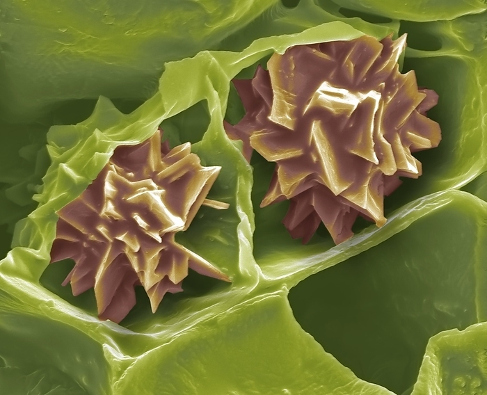 Plant druse crystal, SEM Coloured scanning electron micrograph  SEM  of freeze fractured plant tissue to show druse crystals. Druse crystals are a common occurrence in many plants and are usually granular or star like in shape. Crystal formations that appear needle  or spear shaped are referred to as raphides. Both are thought to deter herbivory, and a number of species of plants are poisonous to humans, as well as animals, due to the high calcium oxalate content. Even a small dose of calcium oxalate is enough to cause intense sensations of burning in the mouth and throat. The crystal s effects or symptoms may last for a week or more. Magnification: 1, 500X when printed at 10 centimetres wide.