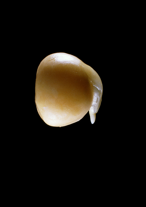 Germination of the garden pea Germination. Macrophotograph of the garden pea Pisum sativum, showing the split seed coat  testa  and the emergence of the embryonic root, or radicle. The image was made 30 hours after germination began.