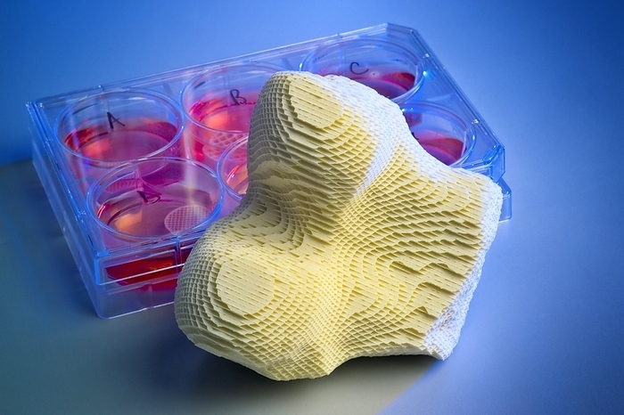 Artificial bone research Artificial bone research. Artificial bone and well plate containing cell culture medium. This artificial bone was created using the same technology as used in the manufacture of car catalytic converters. The highly porous ceramic based bone acts as a scaffold that can be moulded into any shape. The porosity of the scaffold also allows cultured bone cells  osteoblasts  and blood vessels to grow while the the orginal scaffold is eventually resorbed into the body. This artificial bone may one day replace titanium and steel as a suitable material for bone replacement surgery. Photographed in 2009 at Warwick University.