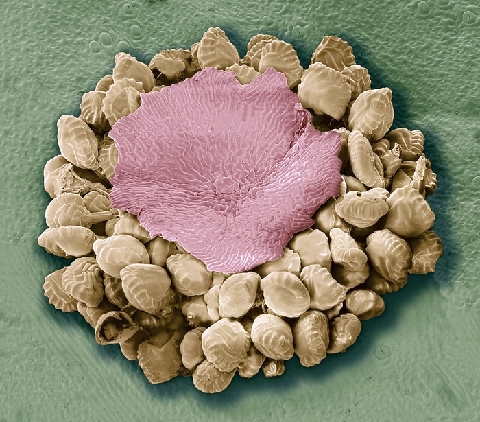 Fern spore cases, SEM Fern spore cases. Coloured scanning electron micrograph  SEM  of a sorus on the underside of a fern leaf. A sorus is a group of sporangia  brown  covered by an umbrella shaped covering known as an indusium  pink . The sporangia contain spores, the reproductive units of the fern.