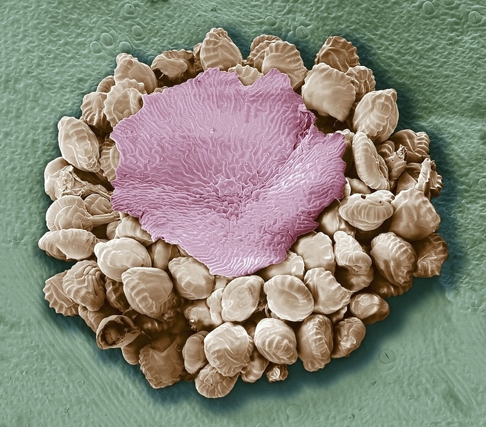 Fern spore cases, SEM Fern spore cases. Coloured scanning electron micrograph  SEM  of a sorus on the underside of a fern leaf. A sorus is a group of sporangia  round lumps  covered by an umbrella shaped covering known as an indusium  pink . The sporangia contain spores, the reproductive units of the fern.