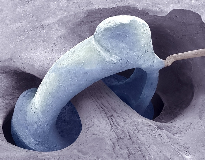 Middle ear bone, SEM Middle ear bone. Coloured scanning electron micrograph  SEM  of the human middle ear, showing the stapes  ring shaped . The stapes is one of three bones  known as the ossicles  in the middle ear that conduct sound waves from the outer ear to the inner ear. Vibrations from the eardrum are passed to the malleus and then the stapes via the incus. The stapes transmits these vibrations to the fluid filled cochlear of the inner ear where they are converted to nerve impulses. Magnification: x100 when printed 10 centimetres wide.